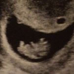 Profile Picture of Shauna.rene.melanson (@shauna_melanson) on Instagram