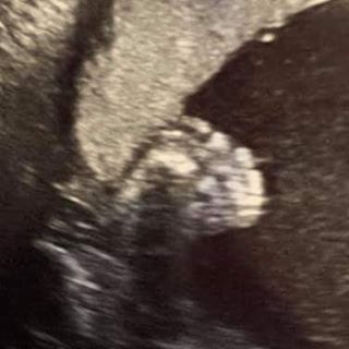 Alice Goeman Metrick - Facebook Profile Picture of Alice Goeman Metrick (@atmetrick) on Facebook