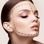 Profile Picture of Клиники эстетической медицины (@lantan_clinic) on Instagram