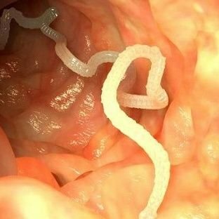 Profile Picture of Joe Biden's Brain Worm (@ChrisOl51004391) on Twitter
