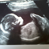 Profile Picture of Lisa Bagnall (@Lisa mummy to be) on Flickr