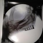 Profile Picture of Jess Corning (@linetrash76) on Instagram