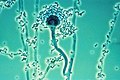 Profile Picture of Aspergillus fumigatuson Wikipedia