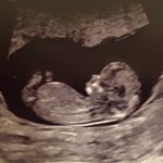 Profile Picture of hazel.clementine (@hazel.clementine) on Instagram