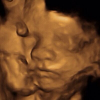 Profile Picture of Overseas Link (@featuringLloyd) on Twitter