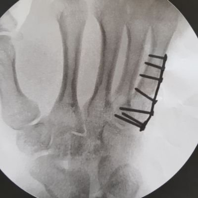 Profile Picture of David Eriksson (@slakmota) on Twitter