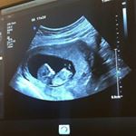 Profile Picture of Kim Dong-Sun (@httpx._.kimdongsun) on Instagram