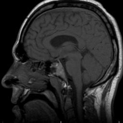 Profile Picture of Christopher Zike (@Sicko_Pasik) on Twitter