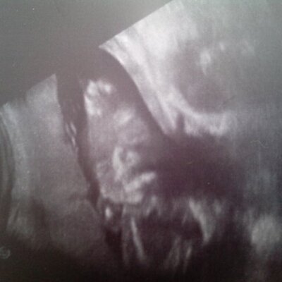 Profile Picture of Erika Piccirilli (@75d566e4ae8a45b) on Twitter