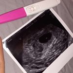 Profile Picture of caitlin_bartlett11 (@caitlin_bartlett11) on Instagram