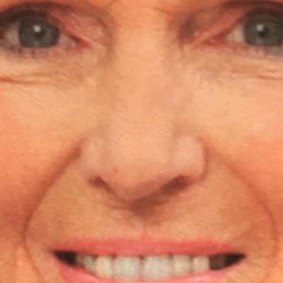 Profile Picture of Brian Burney (@Swagcanceryolo) on Twitter