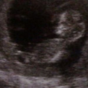 Profile Picture of Aja White (@226689030) on Myspace