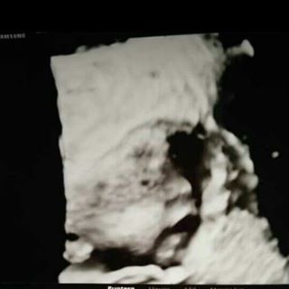 Cecii C. Nuño - Facebook Profile Picture of Cecii C. Nuño (@cecilia.castillo.35912672) on Facebook