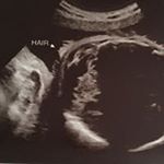 Profile Picture of Scott Spilker (@sspilker_hi) on Instagram