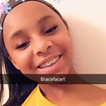 Profile Picture of Brace_Face_Maddie👑😘 (@madisonthompson116) on Instagram