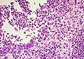 Feline infectious peritonitis - Wikipedia Profile Picture of Feline infectious peritonitison Wikipedia