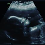 Profile Picture of Heather McFarling (@oneheather) on Instagram