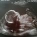 Profile Picture of Paul Contos (@paul.contos.33) on Facebook