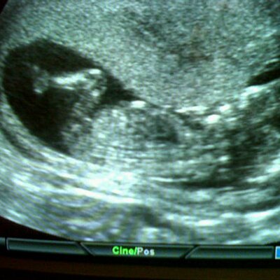 Profile Picture of Ricardo  Zamarron (@pptdkls) on Twitter