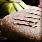 Profile Picture of طب سنتی سوزنی درمان سبز،تهران (@a.mansouri.ap) on Instagram