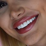 Profile Picture of 🔆مرکز تخصصی دندانپزشکی مایا🌐 (@maya__dental) on Instagram