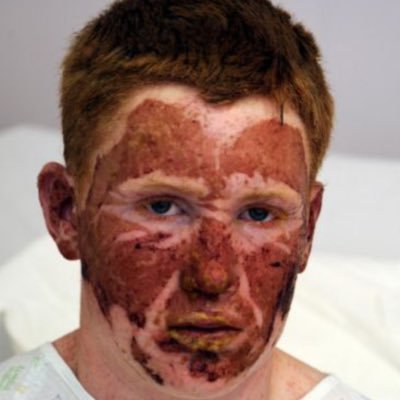 Profile Picture of Jared Callahan (@jaredtheburn) on Twitter