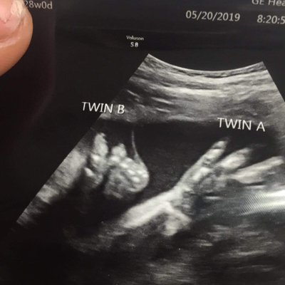 Profile Picture of Jon D Burditt (@BurdittJon) on Twitter