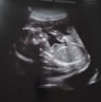 Profile Picture of David Rittenberry (@david.rittenberry.12) on Facebook