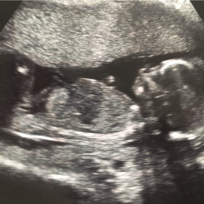 Profile Picture of Richard Backhouse (@backhousr) on Twitter