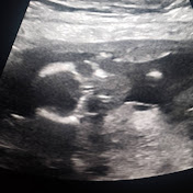 Profile Picture of Tera Martin (@teramartin_) on Youtube