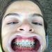 Profile Picture of Shelby Pregler (@pregler0468) on Pinterest
