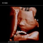 Profile Picture of Christian Adolfo Bernal Pulido (@drchristianabernalpulido) on Instagram