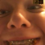 Sophia Dickinson - Instagram Profile Picture of Sophia Dickinson (@poopdedescoopbobs) on Instagram