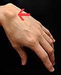 Profile Photo of Ganglion cyston Wikipedia