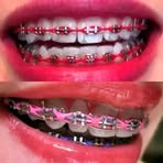 Profile Picture of Jollian Brace (@jollian.brace) on Facebook