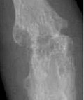 Profile Picture of Arthropathyon Wikipedia