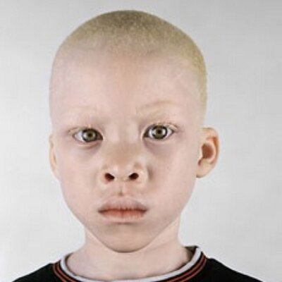 Profile Picture of Barry Kolar (@albino_children) on Twitter