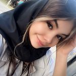 Profile Picture of |آلوپسی(ریزش سکه ای)ریزش مو،کم پشتی ریش| (@magichairoorrg) on Instagram