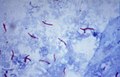 Profile Picture of Multidrug-resistant tuberculosis - Wikipediaon Wikipedia