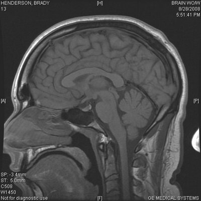 Profile Picture of Brady Henderson (@misterjustice) on Twitter