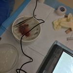 Profile Picture of David Nejat-Bina, MD (@ochairtransplantcenter) on Instagram