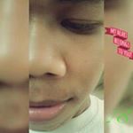 Profile Picture of Alfonso Fernando (@alfonso6658) on Instagram