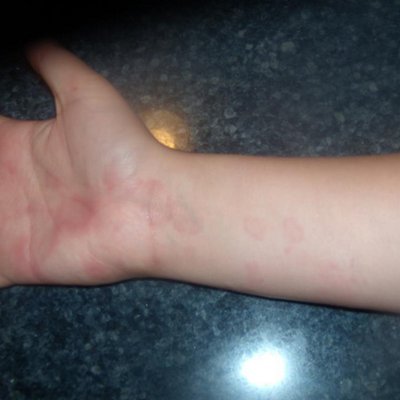 Profile Picture of Jessica Dussault (@gardasilinjured) on Twitter