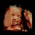 Profile Picture of Robert Grimshaw (@rhea.grimshaw.sharples) on Instagram