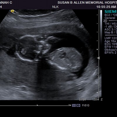 Profile Picture of Hannah Pfeifer (@cutemommy2be) on Twitter