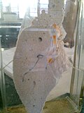 Profile Picture of Cirrhosison Wikipedia