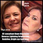 Profile Picture of Dawn C Blackmon (@dawns_greatskin_withrf) on Instagram