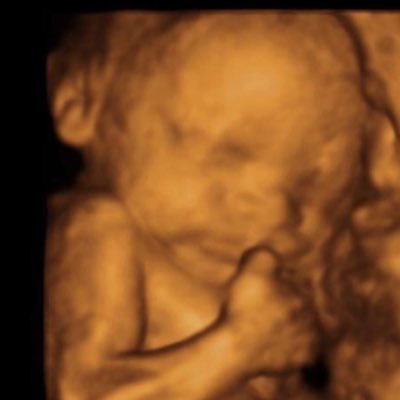 Profile Picture of Andrew Gillett (@andrewgillett7) on Twitter