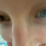 Profile Picture of Mark Skalski (@skalskimd1) on Youtube