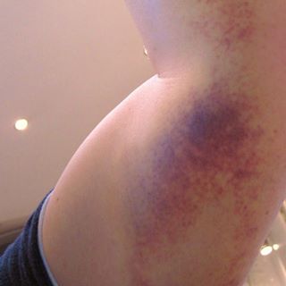 Profile Picture of Jeremy London (@Jeremy-London) on Facebook